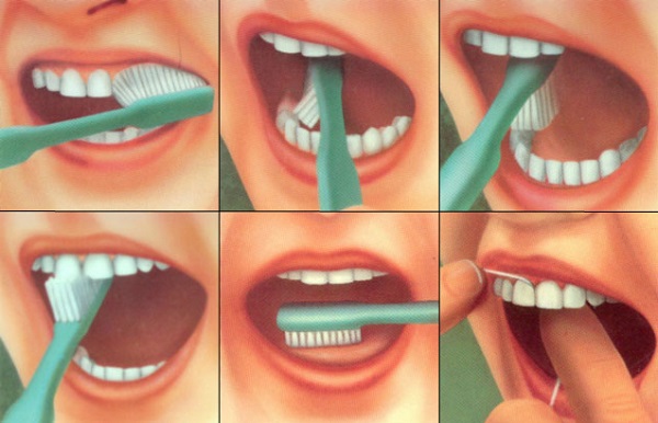 Обучение гигиене зубов