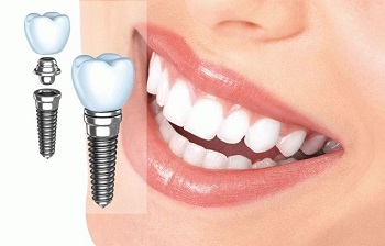 Лечение зубов в Уфе