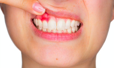 Боли после имплантации зубов – где болит, что делать и период восстановления